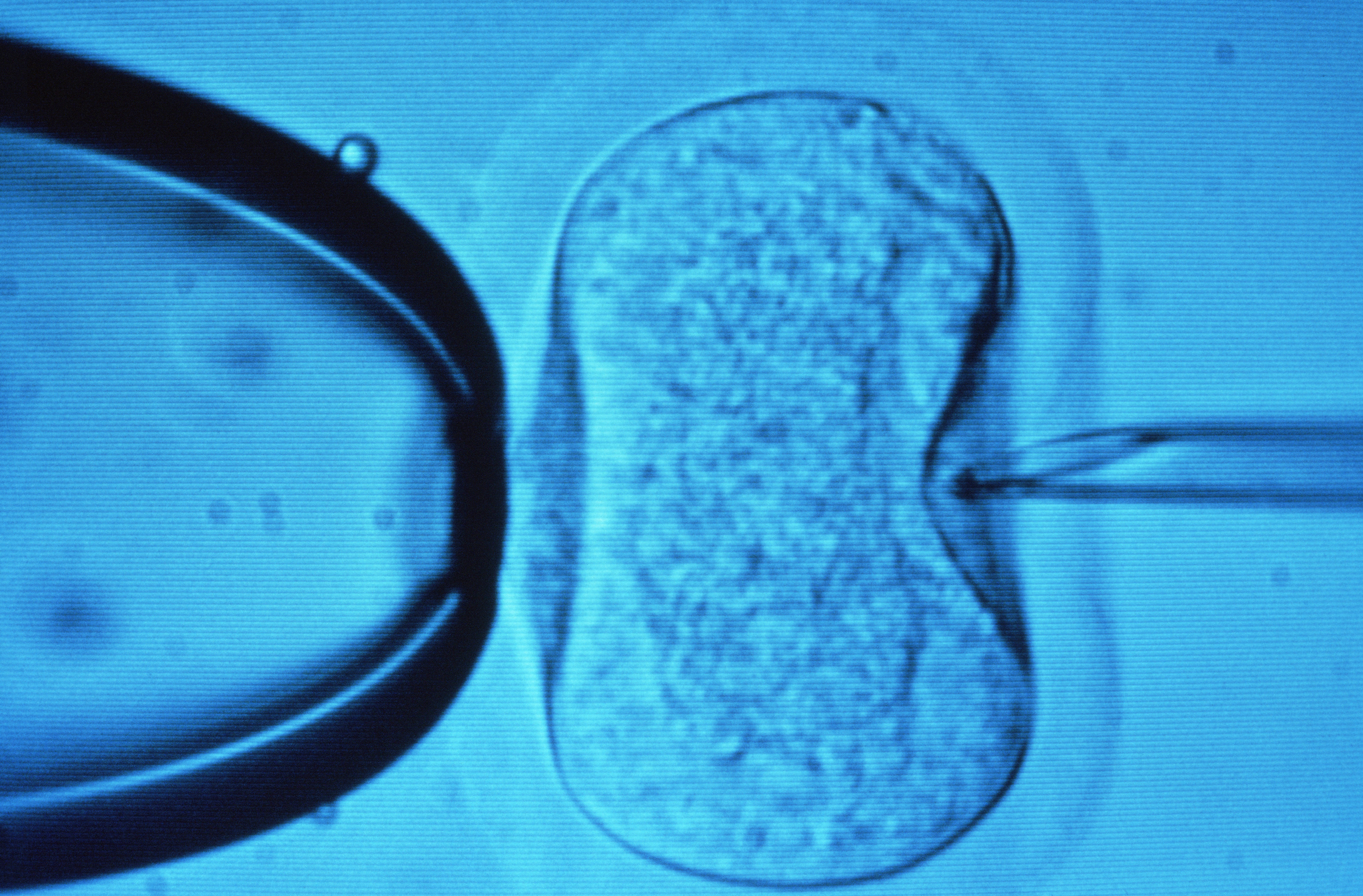 A light microscope image showing the process of <a  href='/glossary/i#in-vitro-fertilisation' data-toggle='popover' data-trigger='hover' title='in vitro fertilisation' data-content='1538' >in vitro fertilisation</a> (IVF). A needle (right) is being used to inject a sperm cell directly into a human egg (centre). A pipette (left) is used to hold the egg steady while the needle is inserted.