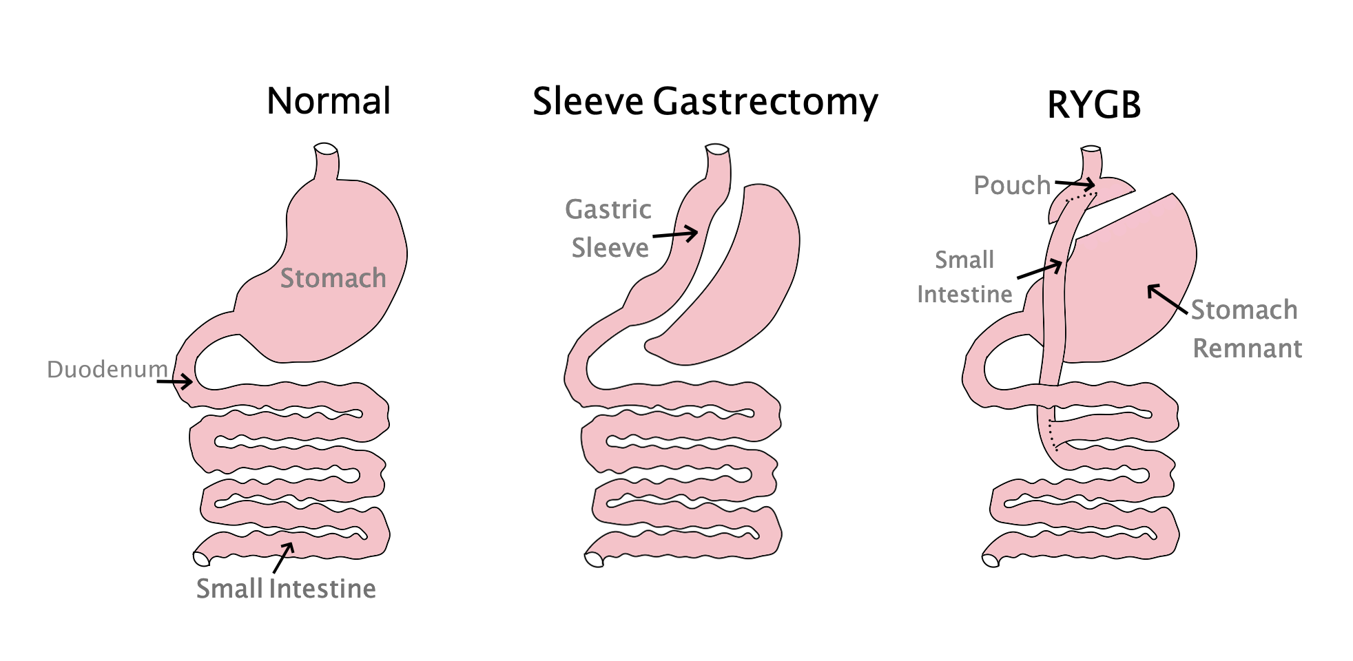 Sufijo qué significa tumor