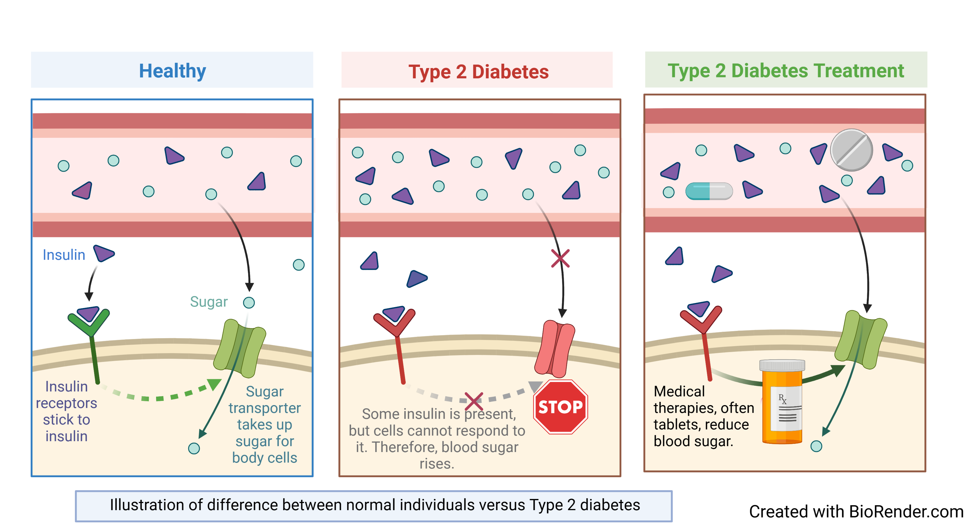 Type 2 Diabetes. Type 1 and Type 2 Diabetes. V2-Рецептор несахарный диабет. Alternative Therapies diagrams. Инсулин через 2 часа