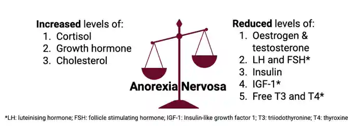 Figure 3 – Hormonal changes in <a  tabindex='0' class='popover-dismiss' href='/endocrine-conditions/eating-disorders-ks4-article/' data-target-type='infoSheet' data-target-url='/endocrine-conditions/eating-disorders-ks4-article/' data-bs-toggle='popover' data-bs-trigger='focus' title='anorexia nervosa' data-bs-content='1331' >anorexia nervosa</a>. Image created with Biorender.