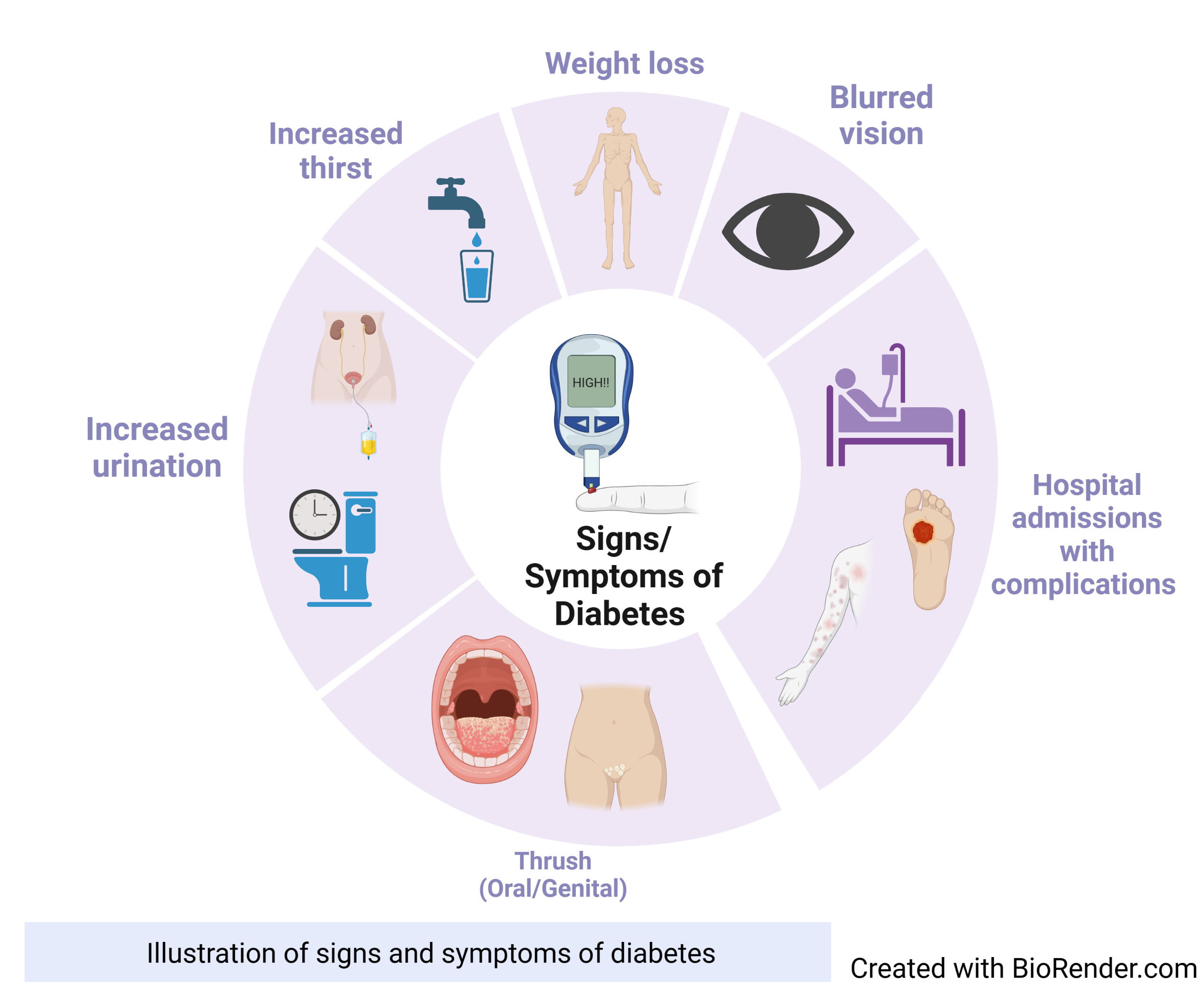 Diabetes and hormone imbalance